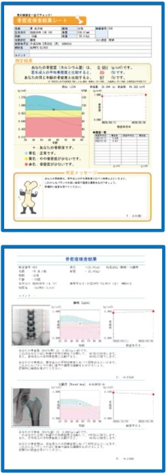 ALPHYS LF の特徴